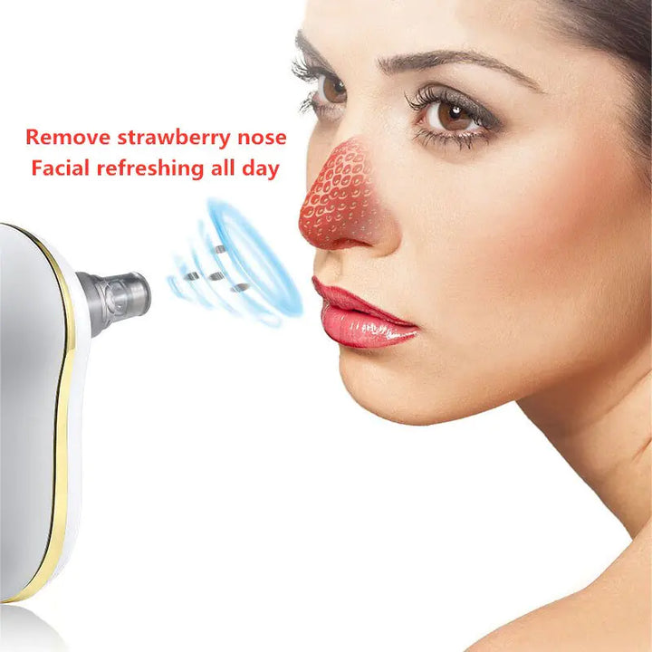 Blackhead Remover